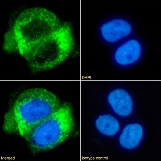 CD63 Chimeric Antibody in Immunocytochemistry (ICC/IF)