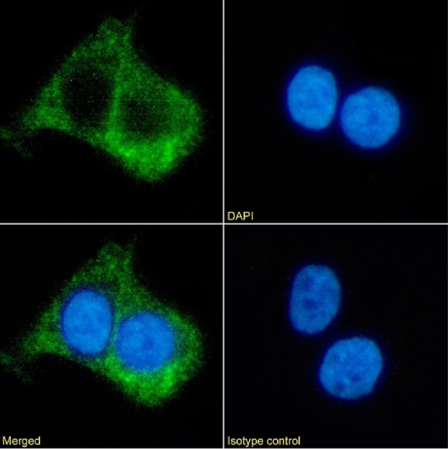 beta-2 Adrenergic Receptor Chimeric Antibody in Immunocytochemistry (ICC/IF)