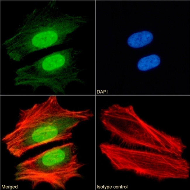 HP1 beta Chimeric Antibody in Immunocytochemistry (ICC/IF)