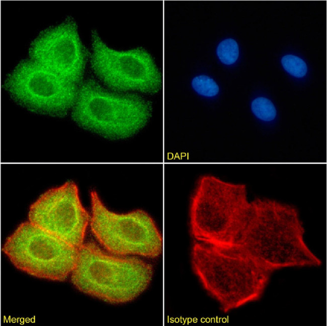 SUV420H2 Chimeric Antibody in Immunocytochemistry (ICC/IF)