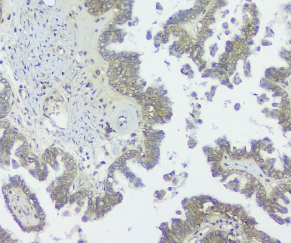 GNAQ Antibody in Immunohistochemistry (Paraffin) (IHC (P))