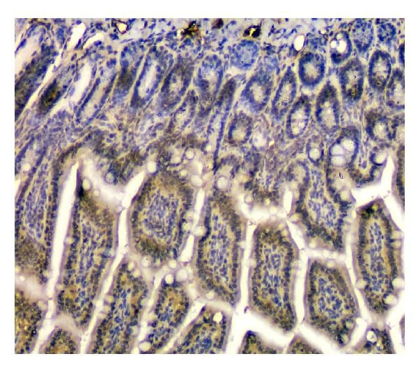 STUB1 Antibody in Immunohistochemistry (Paraffin) (IHC (P))