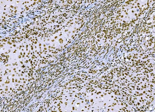 CtBP2 Antibody in Immunohistochemistry (Paraffin) (IHC (P))