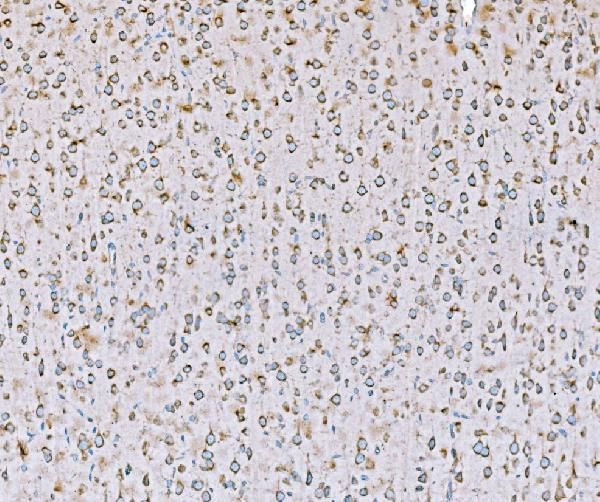 SND1 Antibody in Immunohistochemistry (Paraffin) (IHC (P))