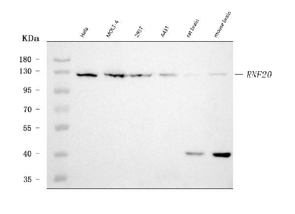 RNF20 Antibody in Western Blot (WB)