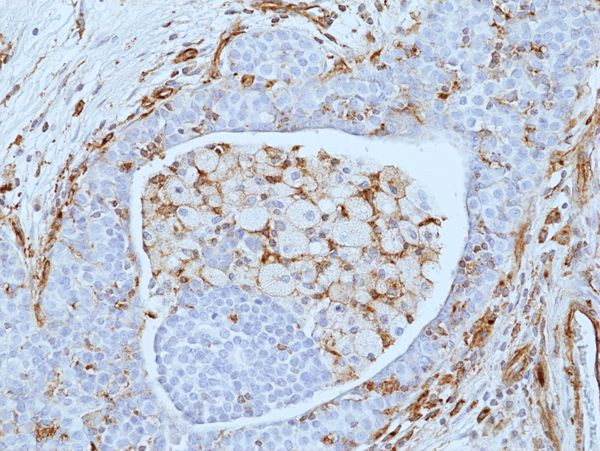 VISTA Antibody in Immunohistochemistry (Paraffin) (IHC (P))