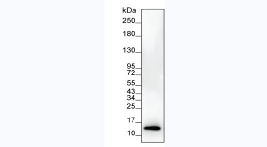 Ferritin Antibody in ELISA (ELISA)