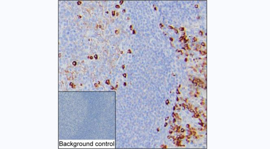 Kappa Light Chain Antibody in Immunohistochemistry (Paraffin) (IHC (P))