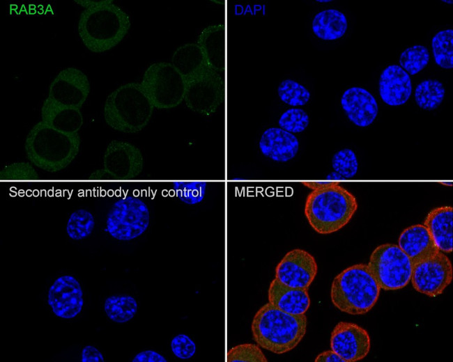 RAB3A Antibody in Immunocytochemistry (ICC/IF)