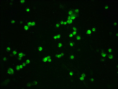 Phospho-beta Catenin (Ser33, Ser37) Antibody in Immunocytochemistry (ICC/IF)