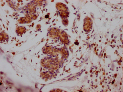 SUZ12 Antibody in Immunohistochemistry (Paraffin) (IHC (P))