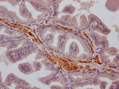 TRPM8 Antibody in Immunohistochemistry (Paraffin) (IHC (P))