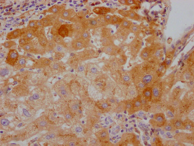 Factor X Antibody in Immunohistochemistry (Paraffin) (IHC (P))