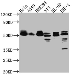 MAPKAPK2 Antibody in Western Blot (WB)