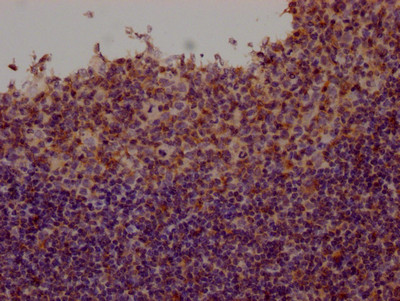 Fyn Antibody in Immunohistochemistry (Paraffin) (IHC (P))