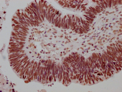 HSF1 Antibody in Immunohistochemistry (Paraffin) (IHC (P))