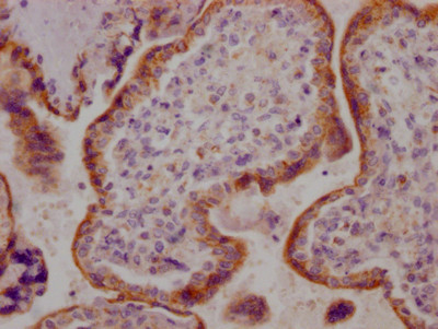 ACVR2B Antibody in Immunohistochemistry (Paraffin) (IHC (P))