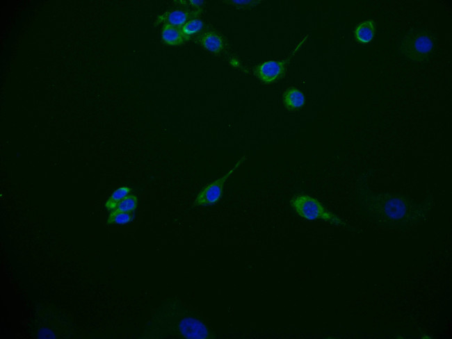 CD49f Antibody in Immunocytochemistry (ICC/IF)