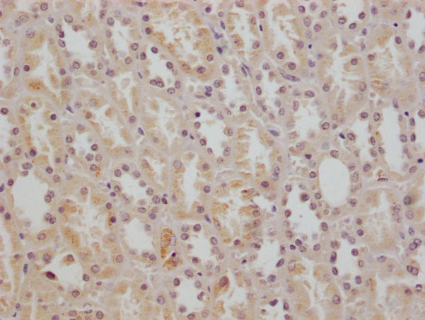 CD147 Antibody in Immunohistochemistry (Paraffin) (IHC (P))