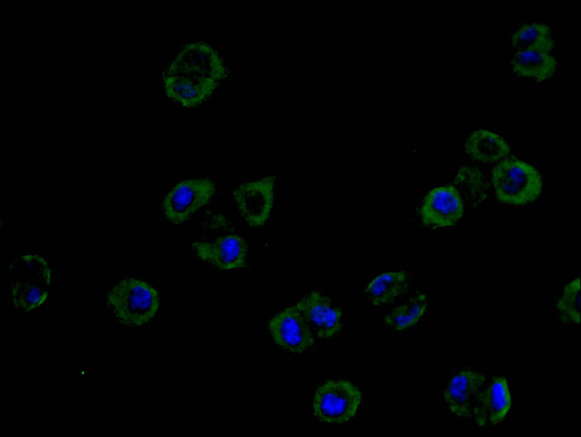 ROBO1 Antibody in Immunocytochemistry (ICC/IF)