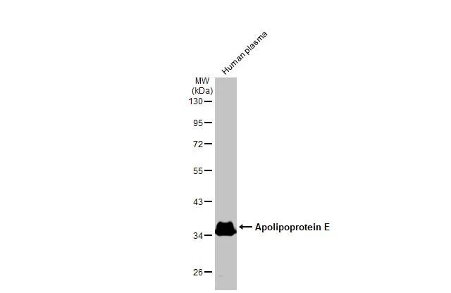 APOE Antibody in Western Blot (WB)