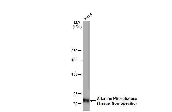 ALPL Antibody in Western Blot (WB)