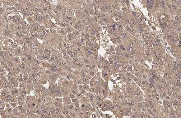 ADFP Antibody in Immunohistochemistry (Paraffin) (IHC (P))