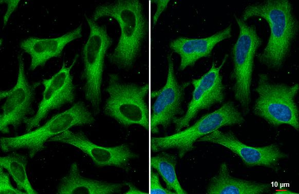 FASN Antibody in Immunocytochemistry (ICC/IF)