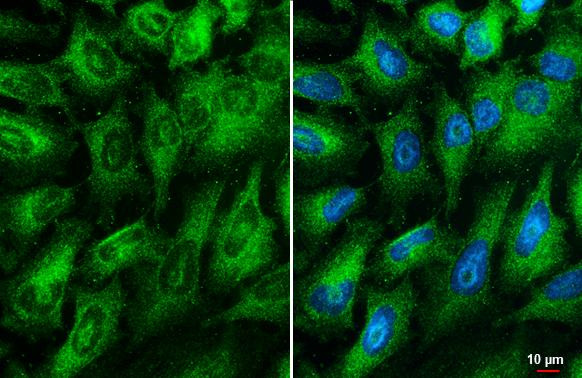 RIP1 Antibody in Immunocytochemistry (ICC/IF)