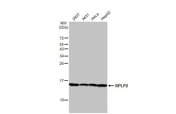 RPLP2 Antibody in Western Blot (WB)