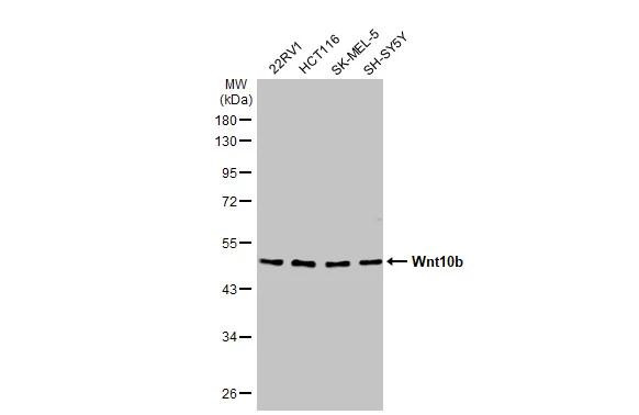 WNT10B Antibody in Western Blot (WB)