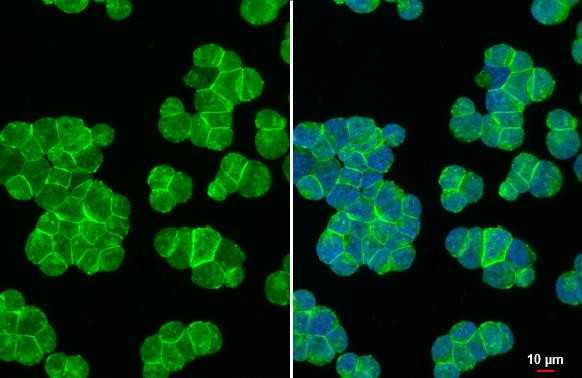 CXCR4 Antibody in Immunocytochemistry (ICC/IF)