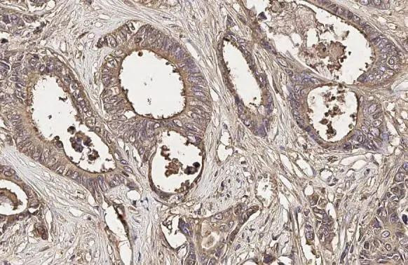 CEA Antibody in Immunohistochemistry (Paraffin) (IHC (P))