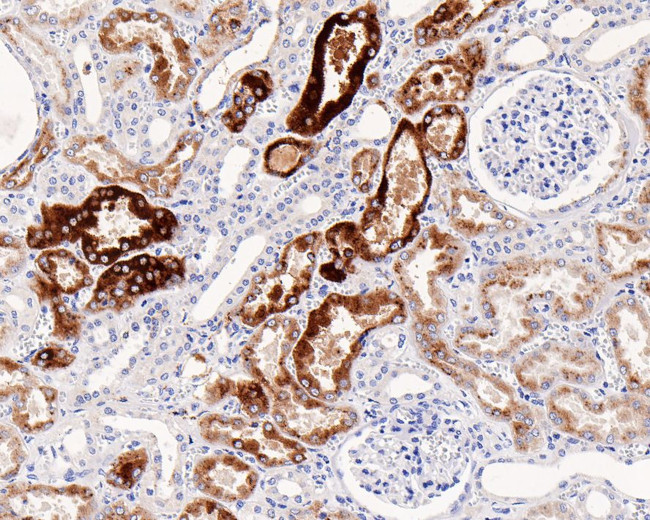 NAPSA Antibody in Immunohistochemistry (Paraffin) (IHC (P))