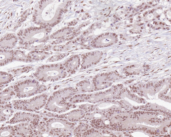 MLH1 Antibody in Immunohistochemistry (Paraffin) (IHC (P))