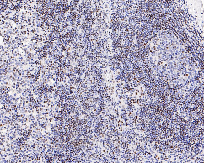 FOXP1 Antibody in Immunohistochemistry (Paraffin) (IHC (P))