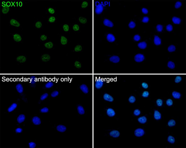 SOX10 Antibody in Immunocytochemistry (ICC/IF)