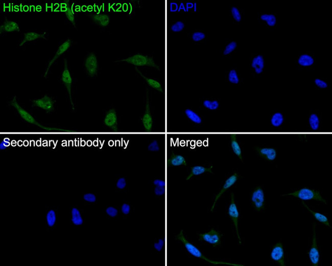 H2BK20ac Antibody in Immunocytochemistry (ICC/IF)
