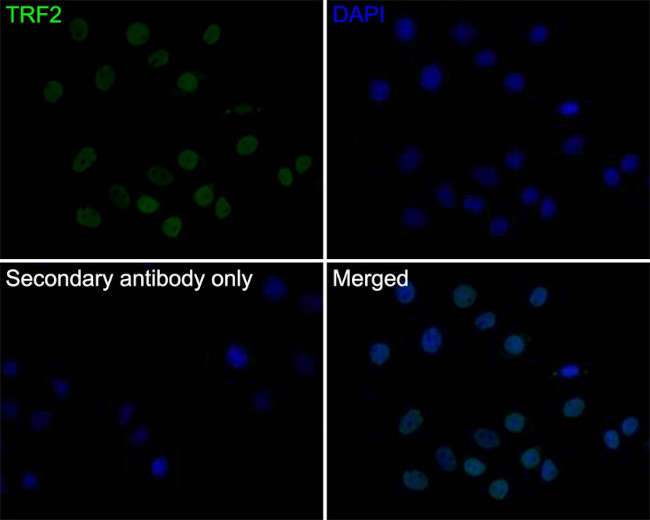TRF2 Antibody in Immunocytochemistry (ICC/IF)