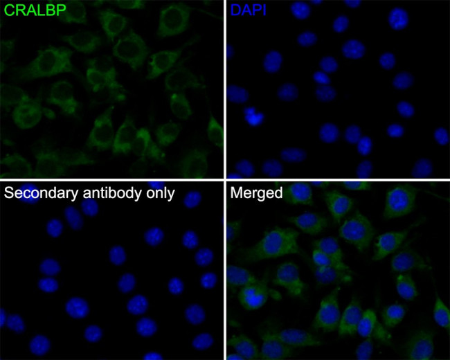 CRALBP Antibody in Immunocytochemistry (ICC/IF)