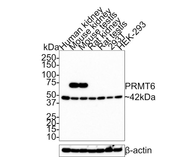 PRMT6 Antibody in Western Blot (WB)