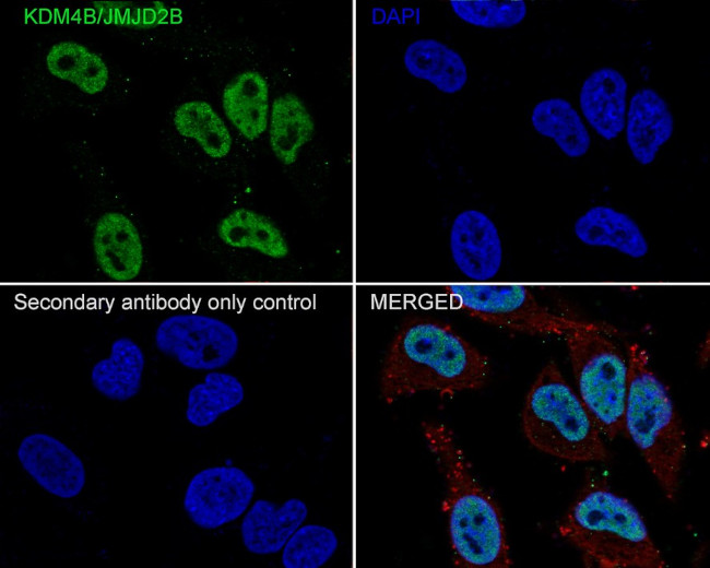 JMJD2B Antibody in Immunocytochemistry (ICC/IF)