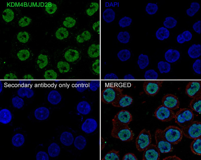 JMJD2B Antibody in Immunocytochemistry (ICC/IF)