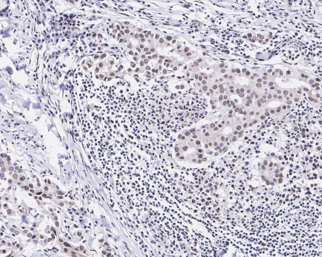 JMJD2B Antibody in Immunohistochemistry (Paraffin) (IHC (P))