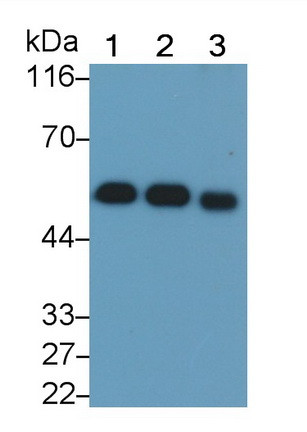 GC Antibody in Western Blot (WB)