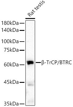 BTRC Antibody in Western Blot (WB)