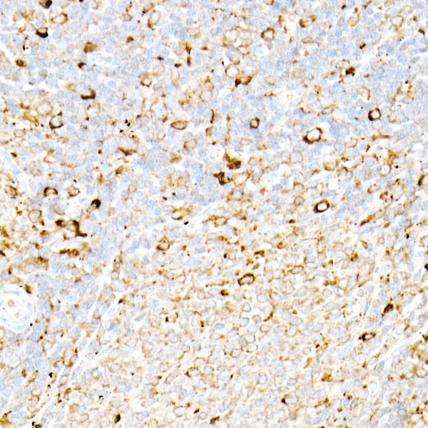 Calreticulin Antibody in Immunohistochemistry (Paraffin) (IHC (P))