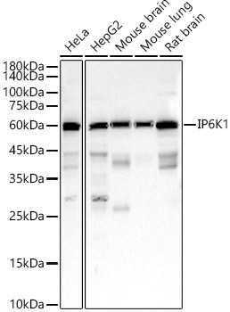 IP6K1 Antibody in Western Blot (WB)