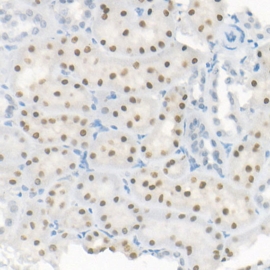 HNF1A Antibody in Immunohistochemistry (Paraffin) (IHC (P))