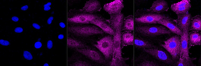 CRYAB Antibody in Immunocytochemistry (ICC/IF)